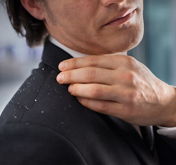 Wie besiegt man lästige Schuppen